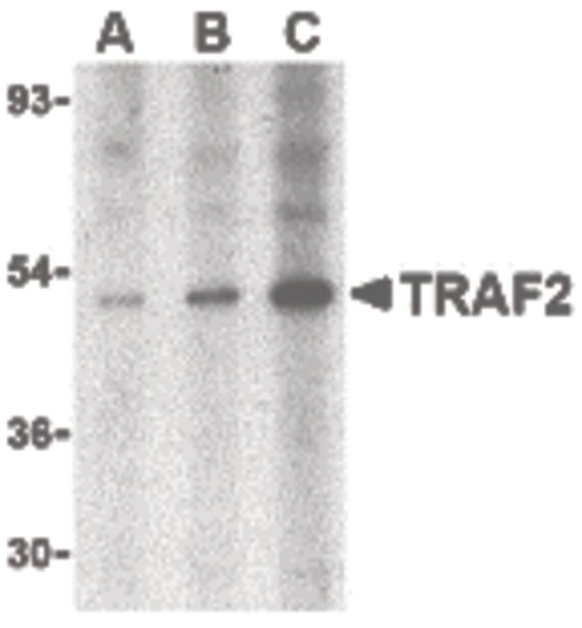 PathPlus™ Polyclonal Rabbit anti-Human TRAF2 Antibody (IHC, IF, WB)