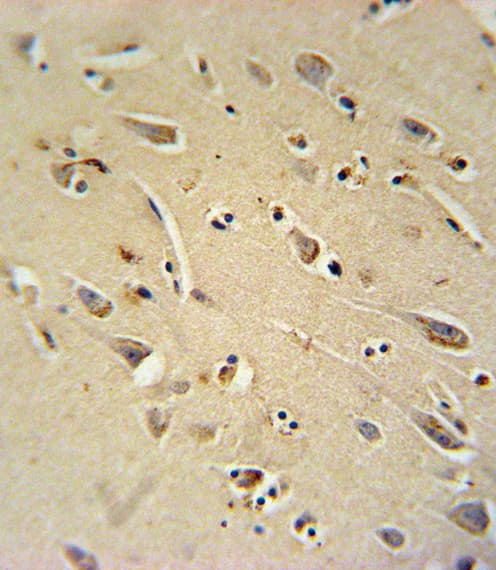 RHOQ / TC10 Antibody (aa48-76)