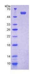 Mouse TMEM27 / Collectrin Protein (Recombinant His-GST)