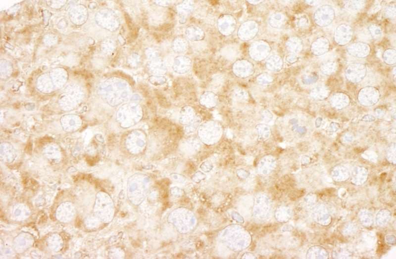 Polyclonal Rabbit anti-Human UVRAG Antibody (aa649-699, IHC)