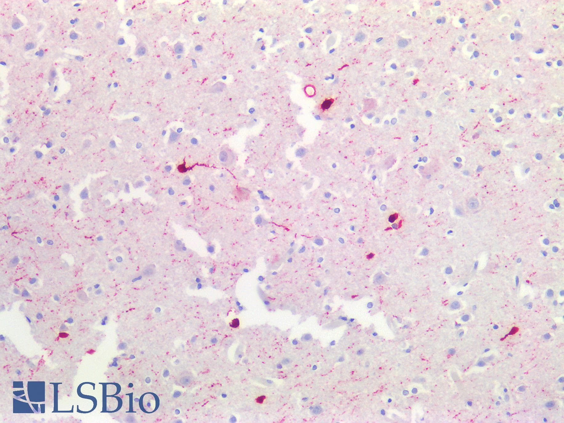 PathPlus™ Polyclonal Rabbit anti-Human CALB2 / Calretinin Antibody (IHC, WB)
