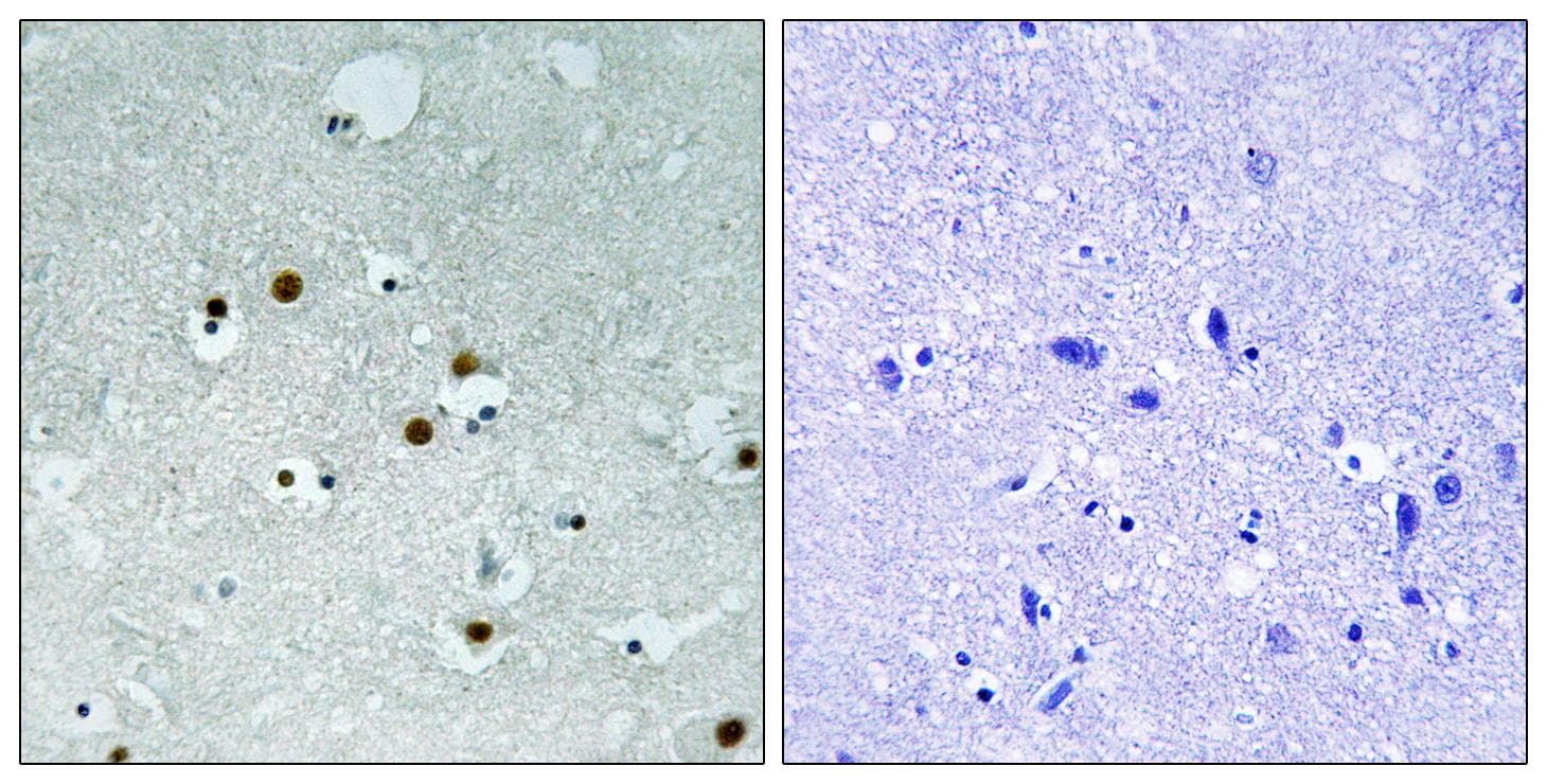 Polyclonal Rabbit anti-Human CBX5 / HP1 Alpha Antibody (p92, IHC, WB)