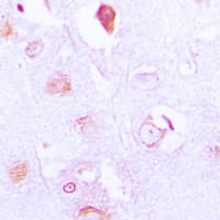 Polyclonal Rabbit anti-Human FXR2 Antibody (C-Terminus, IHC, IF, WB)