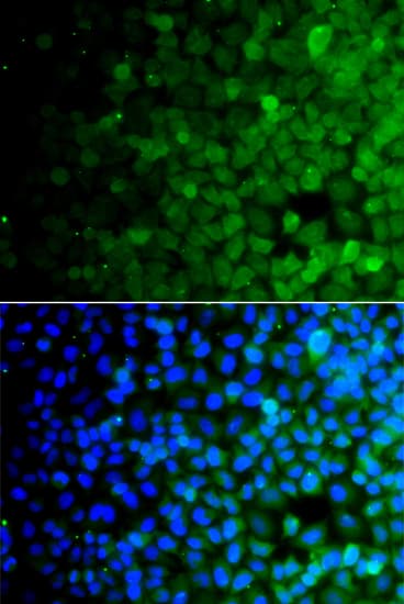 Polyclonal Rabbit anti-Human USP10 Antibody (IHC, IF, WB)