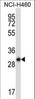 Polyclonal Rabbit anti-Human STX17 / Syntaxin 17 Antibody (aa1-30, WB)