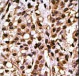 ATG4A Antibody (aa363-392)