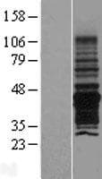 PNMA6A Protein (Over-Expression Lysate Myc-DDK (Flag))