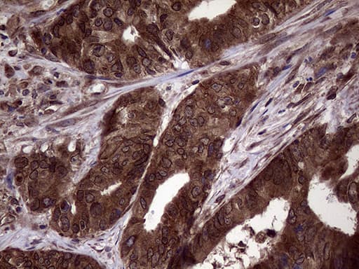 Monoclonal Mouse anti-Human PITPNB Antibody (clone OTI5B10, IHC, WB)