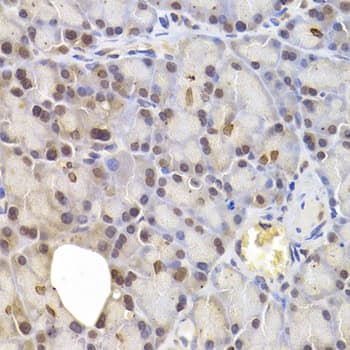 IRF6 Antibody