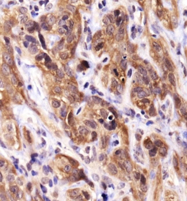 Heat Shock Protein 70 / HSPA1A Antibody