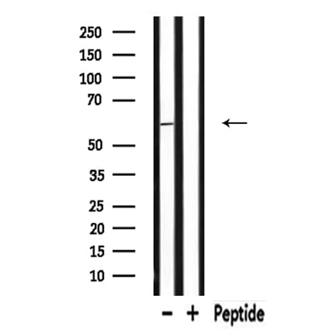RAB11FIP2 / Rab11-FIP2 Antibody