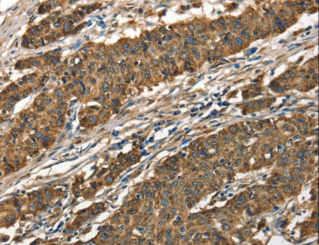 CTSE / Cathepsin E Antibody