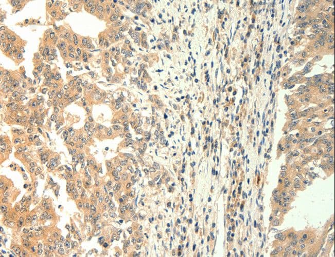 Polyclonal Rabbit anti-Human TRPM5 Antibody (IHC, WB)