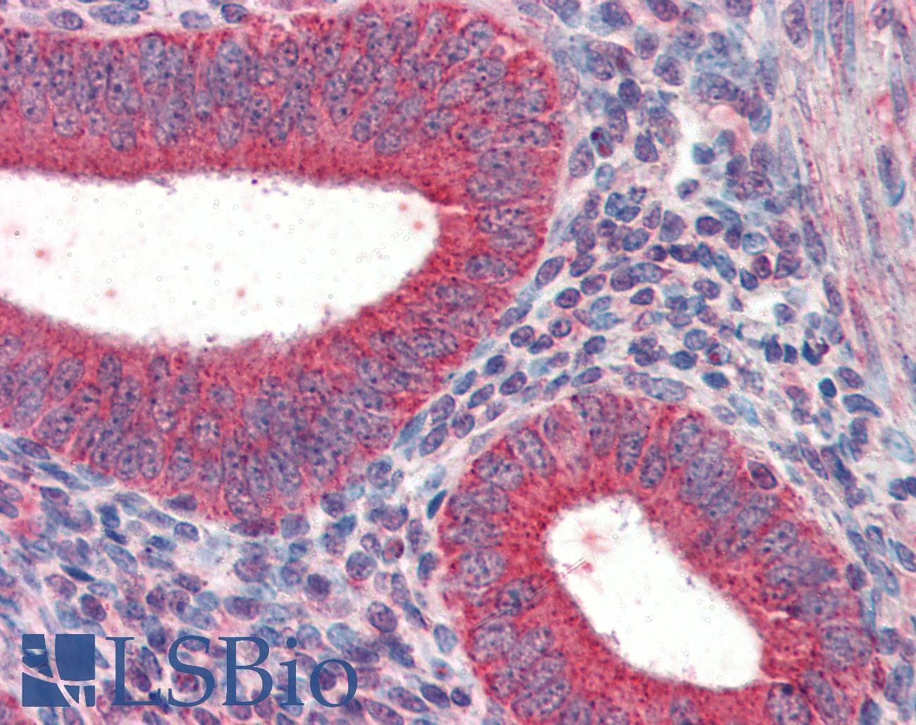 IHC-plus™ TRIM5 Antibody (N-Terminus)
