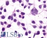 PathPlus™ GRM3 / MGLUR3 Antibody (N-Terminus)