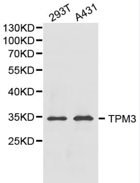Polyclonal Rabbit anti-Human TPM3 Antibody (IHC, WB)