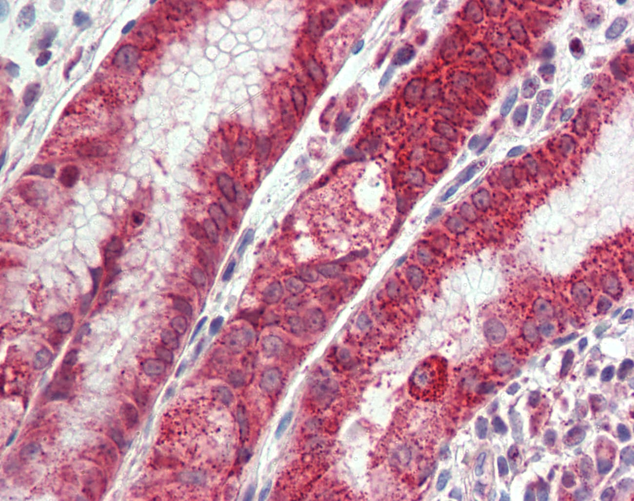 IHC-plus™ CXADR Antibody (Internal)