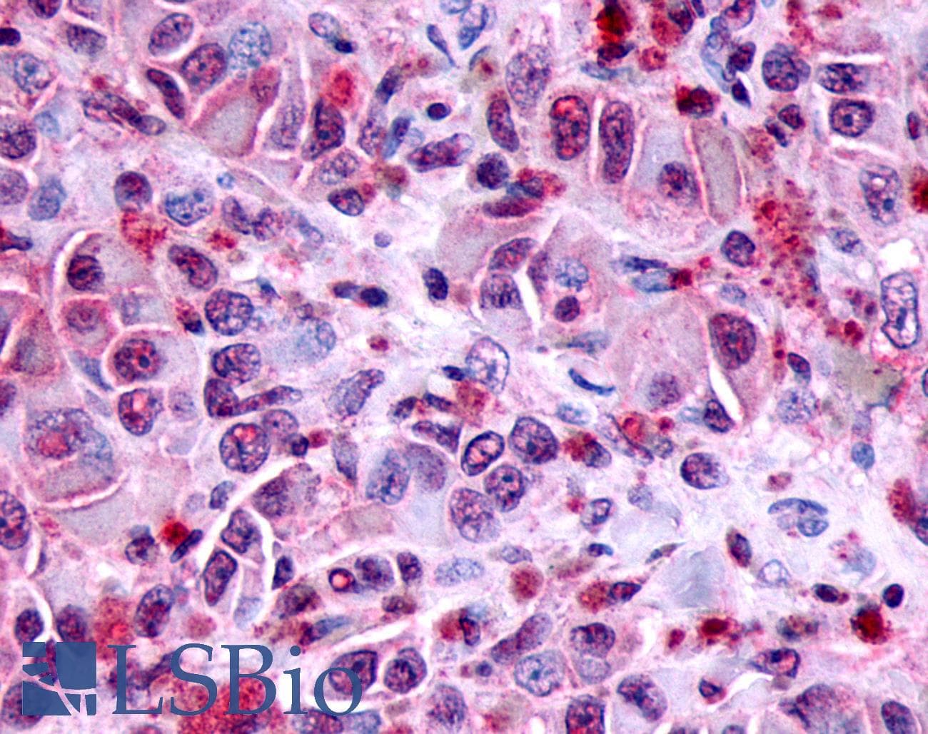 PathPlus™ FZD8 / Frizzled 8 Antibody (N-Terminus)