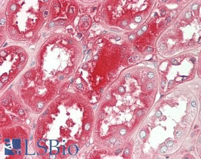 IHC-plus™ Monoclonal Mouse anti-Human SERPING1 / C1 Inhibitor Antibody (clone KT28, IHC)