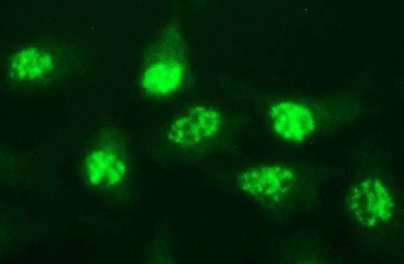 MYC / c-Myc Antibody (clone OTI5E9G2, Carrier-free)
