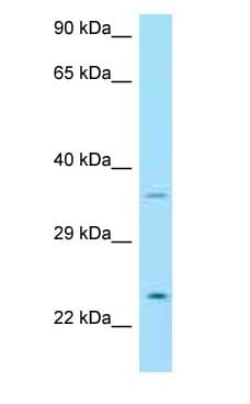 Polyclonal Rabbit anti-Human NRTN / Neurturin Antibody (C-Terminus, WB)