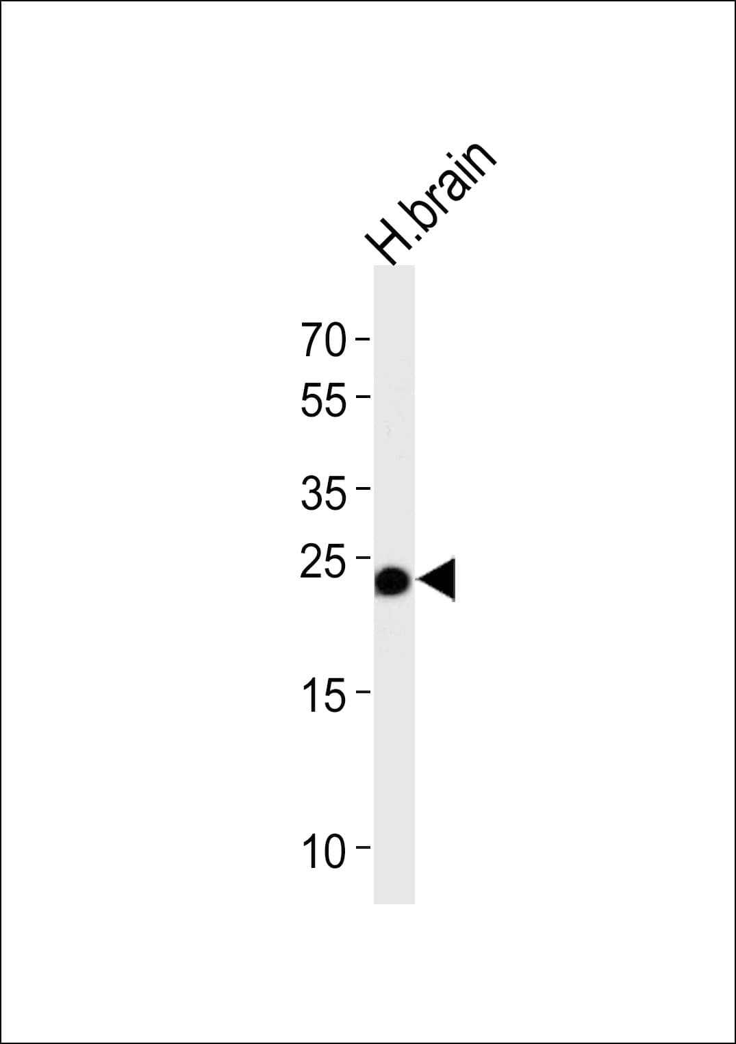 GSTM5-5 / GSTM5 Antibody (aa14-43)