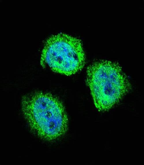 STAT4 Antibody (aa666-695)