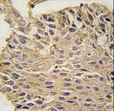 ALDOA / Aldolase A Antibody (aa303-331)