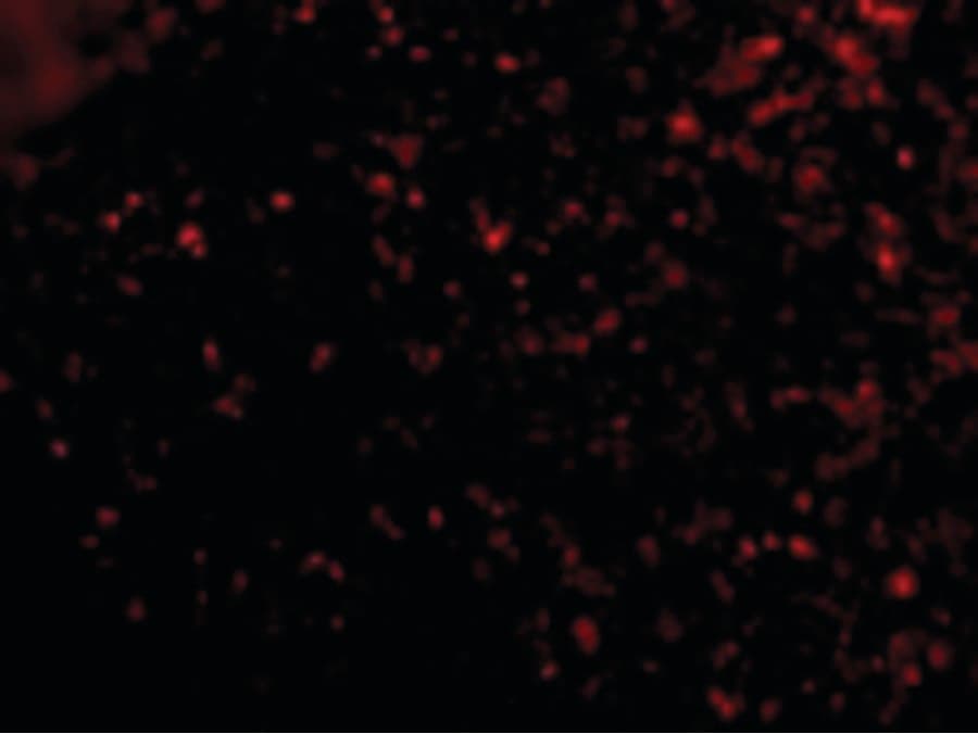 Polyclonal Rabbit anti-Human TMEM142A / ORAI1 Antibody (IHC, IF, WB)