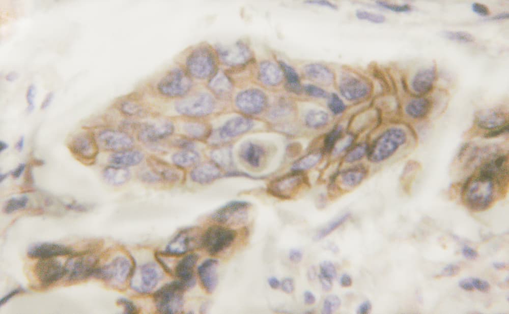 Polyclonal Rabbit anti-Human EGFR Antibody (phospho-Tyr1016, IHC, IF, WB)