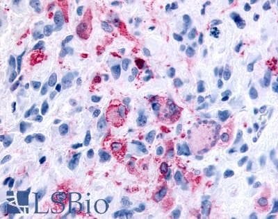 PathPlus™ FFAR2 / GPR43 Antibody (Extracellular Domain)