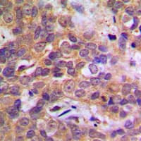 MAPK14 / p38 Antibody (Internal)