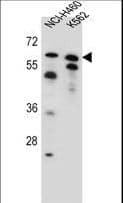 Polyclonal Rabbit anti-Human PLAG1 Antibody (aa8-35, WB)