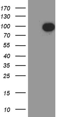 Monoclonal Mouse anti-Human NUMBLIKE / NUMBL Antibody (clone OTI8D2, aa1-225, WB)