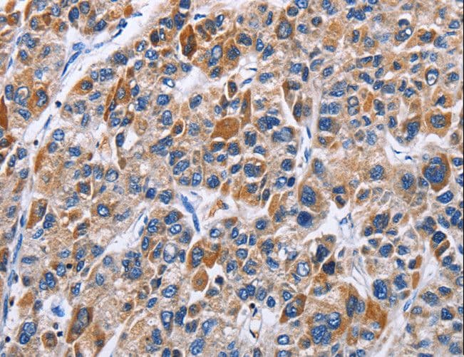 ENPP5 Antibody