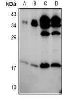 BIK Antibody