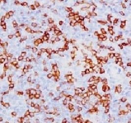 CD8A / CD8 Alpha Antibody (clone SPM548, Azide-free, BSA-free)