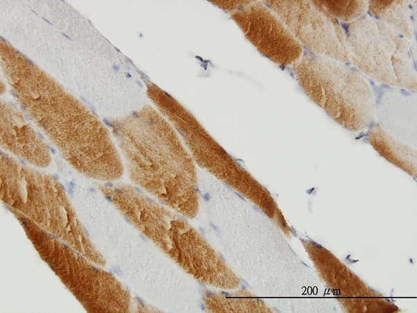 SDHC Antibody (clone 3E2)