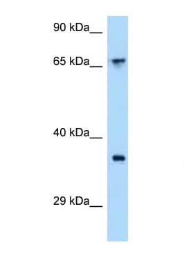 ACKR4 / CCRL1 / CCR11 Antibody (C-Terminus)