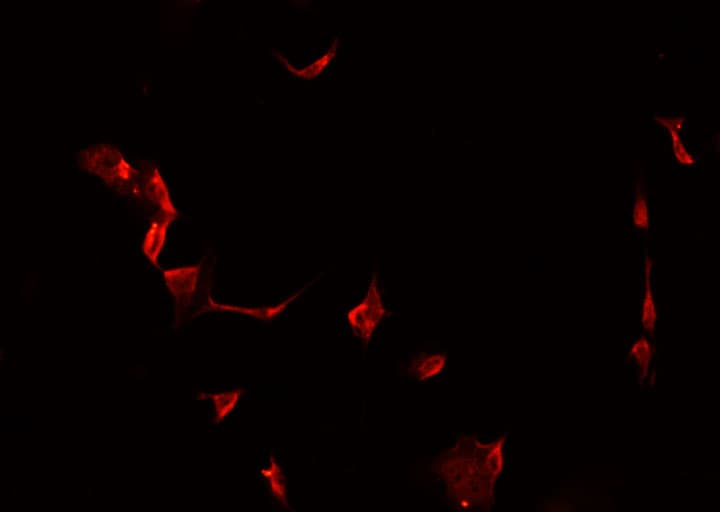 Polyclonal Rabbit anti-Human MAST4 Antibody (IHC, IF, WB)