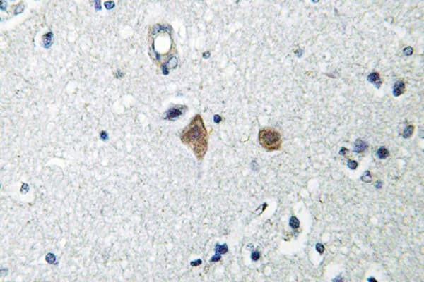Polyclonal Rabbit anti-Human MTOR Antibody (phospho-Ser2448, IHC, WB)