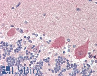 IHC-plus™ Polyclonal Rabbit anti-Human GPD2 Antibody (IHC, WB)