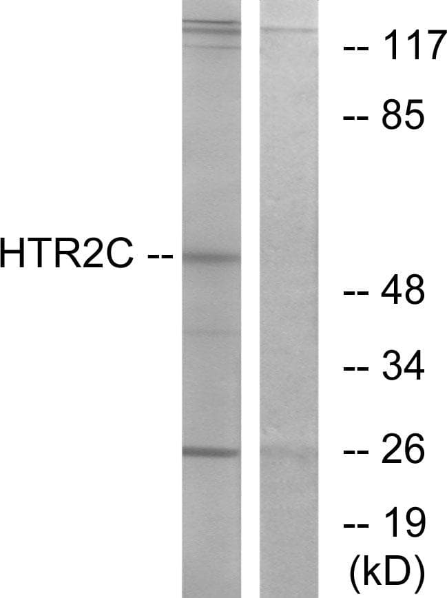 HTR2C / 5-HT2C Receptor Antibody
