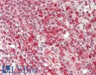 HNF1B / HNF1 Beta Antibody (aa43-92)