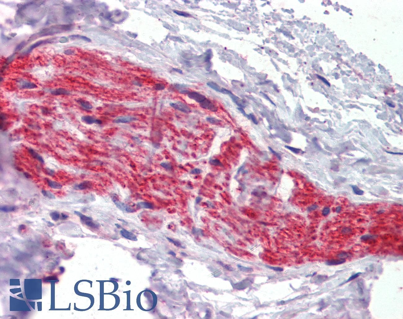 IHC-plus™ Polyclonal Goat anti-Human ANK3 / ANKYRIN-G Antibody (aa1690-1701, IHC)
