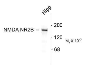 Polyclonal Rabbit anti-Rat GRIN2B / NMDAR2B / NR2B Antibody (C-Terminus, IHC, WB)