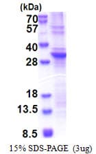 Human SLA2 / SLAP2 Protein (Recombinant His)