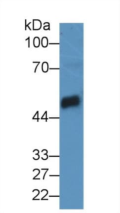 CPB / Carboxypeptidase B Antibody (aa120-415, PE)