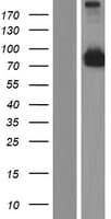 CCDC114 Protein (Over-Expression Lysate Myc-DDK (Flag))