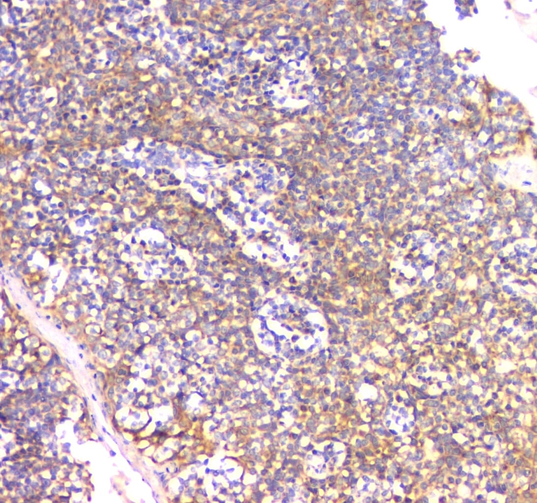 IFN Gamma / Interferon Gamma Antibody